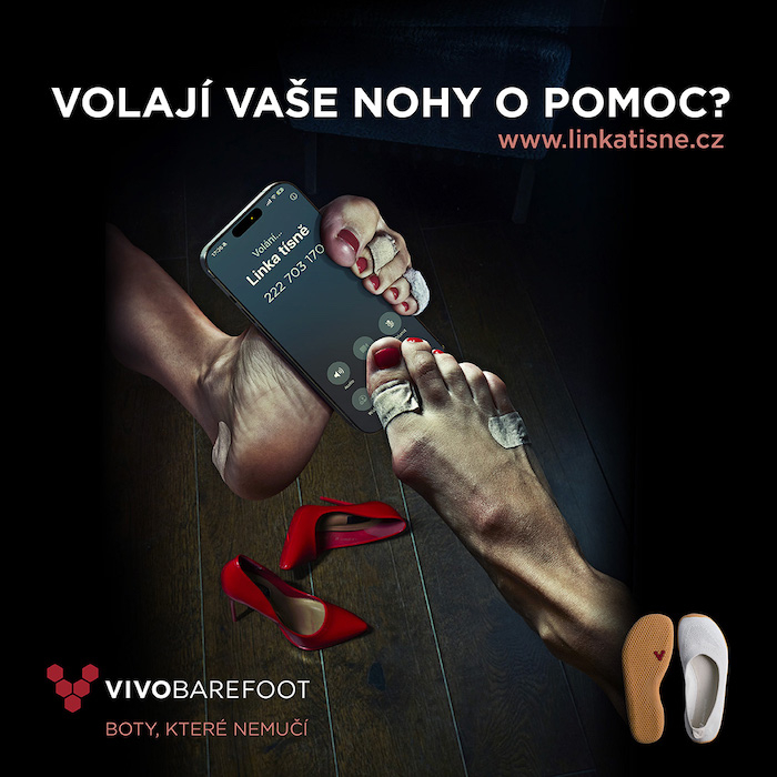 /media/1zqllsjp/vivo_kampan_25_zenska_noha